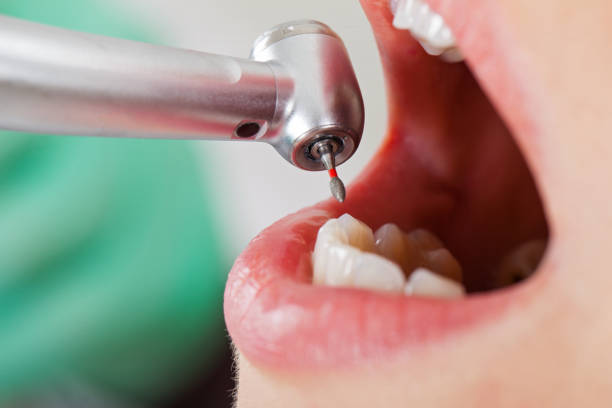 Best Emergency Dental Care for Abscessed Tooth in Cibolo, TX